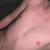 Lukas_69