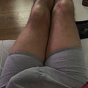 Cumusemyholes