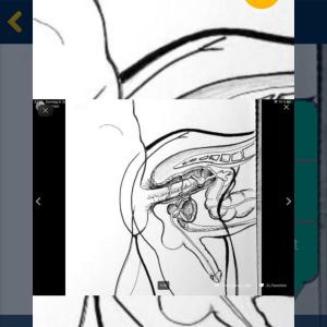 Sex in Olpe,Drolshagen und Wenden