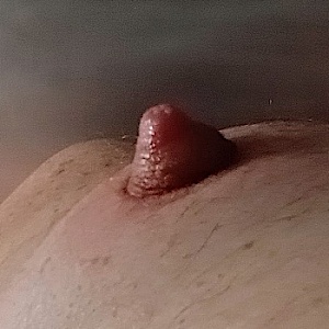 PAT-5217