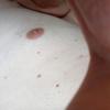 FKKPenis57bi