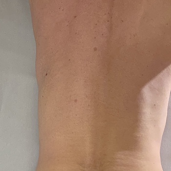 AnonymosWuppertal