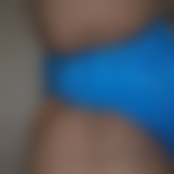 Hairyboy82