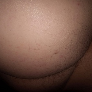 Dick6441